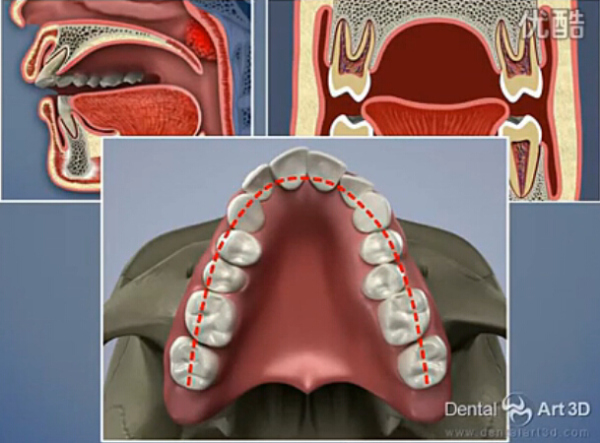 用鼻子和用嘴呼吸对脸型真的有影响么?